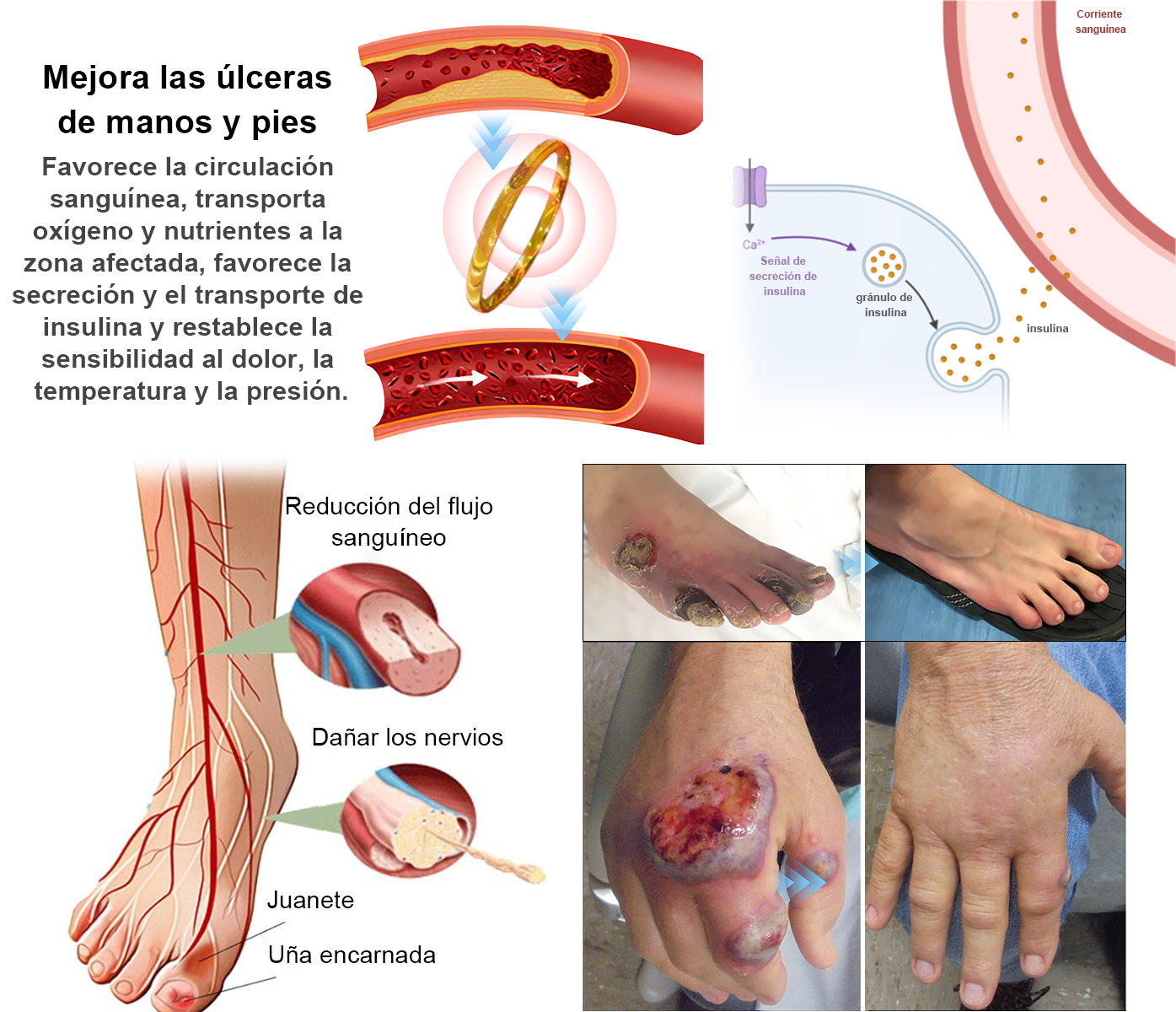 Anillo de ojo de gato con terapia magnética linfática 💖 Descuento por tiempo limitado