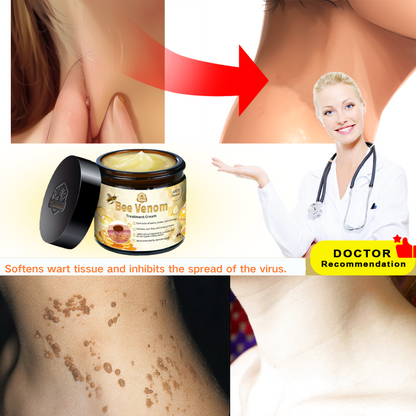 Turonu™ Bee Venom Treatment Cream for Scar Removal, Warts, Skin Tags, Tinea 🐝