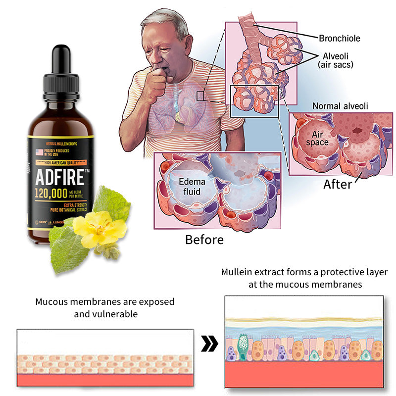 ADFIRE™ Herbal Mullein Drops - Immune Support,Detox & Respiratory Support（🔥Limited Time Discount🔥）