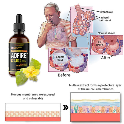 ADFIRE™ Herbal Mullein Drops - Immune Support,Detox & Respiratory Support（🔥Limited Time Discount🔥）